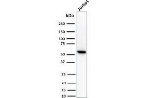 Western Blot Analysis of human Jurkat cell lysate using Topo I, MT Mouse Monoclonal Antibody (TOP1MT/488). (TOP1MT 抗体)