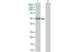 Western Blot analysis of GDI1 expression in transfected 293T cell line by GDI1 MaxPab polyclonal antibody. (GDI1 抗体  (AA 1-447))