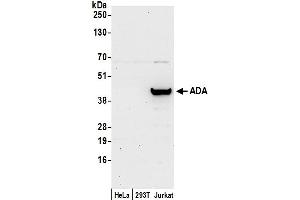 Western Blotting (WB) image for anti-Adenosine Deaminase (ADA) (AA 1-50) antibody (ABIN7449943)