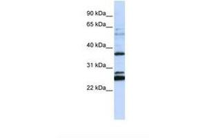 Image no. 1 for anti-Family with Sequence Similarity 70, Member A (FAM70A) (AA 108-157) antibody (ABIN6738344)