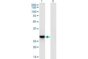 Western Blot analysis of DNAJC27 expression in transfected 293T cell line by DNAJC27 monoclonal antibody (M09), clone 3C1. (DNAJC27 抗体  (AA 1-273))
