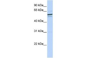 WB Suggested Anti-GPNMB Antibody Titration:  1 ug/ml  Positive Control:  293T cells lysate (Osteoactivin 抗体  (N-Term))