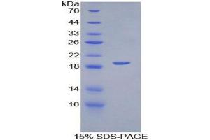 SDS-PAGE analysis of Mouse PECAM1 Protein. (CD31 蛋白)