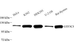 Western Blotting (WB) image for anti-General Transcription Factor IIIC, Polypeptide 3, 102kDa (GTF3C3) antibody (ABIN7074039)