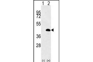 Western blot analysis of LUC7L (arrow) using rabbit polyclonal LUC7L Antibody (Center) (ABIN656137 and ABIN2845476). (LUC7L 抗体  (AA 219-246))