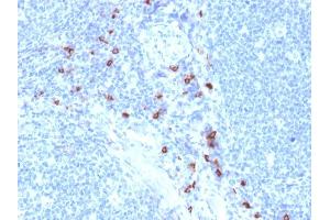 Formalin-fixed, paraffin-embedded human Tonsil stained with Tryptase Mouse Monoclonal Antibody (TPSAB1/1963). (TPSAB1 抗体  (AA 115-233))