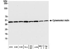 Western Blotting (WB) image for anti-Cytoskeletal Actin (CIMG_00972) (N-Term) antibody (ABIN7453594) (Cytoskeletal Actin (CIMG_00972) (N-Term) 抗体)