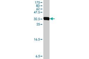 Western Blotting (WB) image for anti-Transient Receptor Potential Cation Channel, Subfamily A, Member 1 (TRPA1) (AA 1033-1117) antibody (ABIN563896)