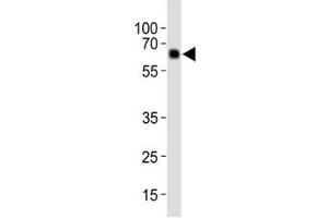 Western Blotting (WB) image for anti-PTEN Induced Putative Kinase 1 (PINK1) (AA 118-147) antibody (ABIN3032405)