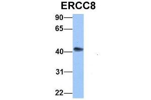 Western Blotting (WB) image for anti-Excision Repair Cross-Complementing Rodent Repair Deficiency, Complementation Group 8 (ERCC8) (C-Term) antibody (ABIN2777347)