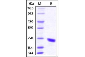SDS-PAGE (SDS) image for CD40 Ligand (CD40LG) (AA 115-260) (Active) protein (His tag) (ABIN4949165)