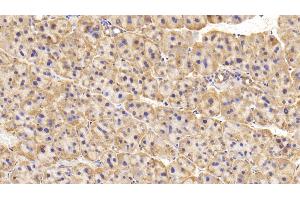 Detection of TH in Rat Adrenal gland Tissue using Polyclonal Antibody to Tyrosine Hydroxylase (TH) (Tyrosine Hydroxylase 抗体  (AA 34-301))