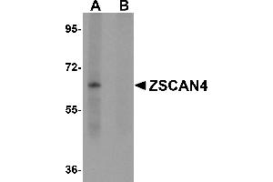 Western Blotting (WB) image for anti-Zinc Finger and SCAN Domain Containing 4 (ZSCAN4) (C-Term) antibody (ABIN1030831) (ZSCAN4 抗体  (C-Term))