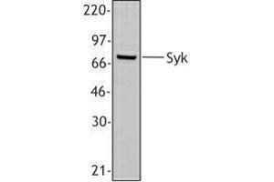 Western Blotting (WB) image for anti-Spleen tyrosine Kinase (SYK) (AA 5-360) antibody (ABIN2665374) (SYK 抗体  (AA 5-360))