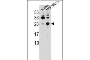 CBLN2 Antibody (C-term) (ABIN655780 and ABIN2845215) western blot analysis in mouse brain tissue and MDA-M cell line lysates (35 μg/lane). (CBLN2 抗体  (C-Term))