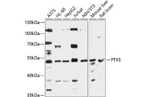 Western blot analysis of extracts of various cell lines, using PTX3 antibody (ABIN6129313, ABIN6146488, ABIN6146490 and ABIN6216395) at 1:3000 dilution. (PTX3 抗体  (AA 18-240))