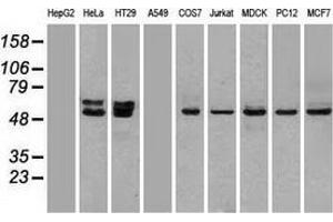 Western blot analysis of extracts (35 µg) from 9 different cell lines by using anti-OXSR1 monoclonal antibody. (OXSR1 抗体)