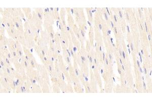 Detection of LAMb2 in Rat Cardiac Muscle Tissue using Polyclonal Antibody to Laminin Beta 2 (LAMb2) (LAMB2 抗体  (AA 939-1129))