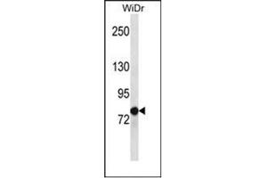 Western blot analysis of LZTS2 Antibody (LZTS2 抗体  (C-Term))