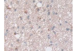 Immunohistochemistry (IHC) image for anti-N-Acylsphingosine Amidohydrolase (Acid Ceramidase) 1 (ASAH1) (AA 144-395) antibody (ABIN7434806)