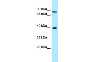 WB Suggested Anti-RPP30 Antibody Titration: 1. (RPP30 抗体  (C-Term))
