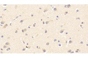 Immunohistochemistry (IHC) image for anti-Peroxiredoxin 4 (PRDX4) (AA 6-249) antibody (ABIN7436120)