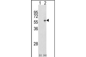 Western blot analysis of CCT3 (arrow) using rabbit polyclonal CCT3 Antibody (Center) (ABIN389422 and ABIN2839505).
