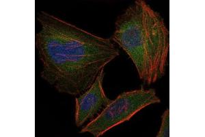 Immunofluorescence (IF) image for anti-Fast Skeletal Troponin I (TNNI2) antibody (ABIN1107197) (TNNI2 抗体)