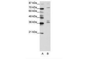 Image no. 1 for anti-A Kinase (PRKA) Anchor Protein (Yotiao) 9 (AKAP9) (N-Term) antibody (ABIN203051) (AKAP9 抗体  (N-Term))