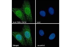 Immunofluorescence (IF) image for anti-Peptidyl Arginine Deiminase, Type IV (PADI4) (N-Term) antibody (ABIN185308)
