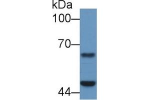 Western Blotting (WB) image for anti-Proteasome (Prosome, Macropain) 26S Subunit, ATPase, 4 (PSMC4) (AA 1-418) antibody (ABIN7442066)