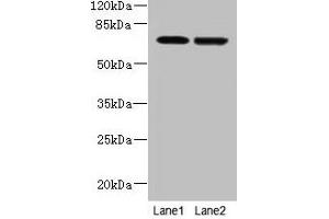 Western blot All lanes: NETO2 antibody at 4 μg/mL Lane 1: U251 whole cell lysate Lane 2: MDA-MB-231 whole cell lysate Secondary Goat polyclonal to rabbit IgG at 1/10000 dilution Predicted band size: 60, 23, 59 kDa Observed band size: 70 kDa (NETO2 抗体  (AA 378-525))