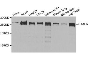 Western blot analysis of extracts of various cell lines, using CKAP5 antibody (ABIN5996436) at 1/1000 dilution. (CKAP5 抗体)