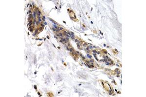 Immunohistochemistry of paraffin-embedded human normal breast using PKLR antibody at dilution of 1:200 (400x lens). (PKLR 抗体)