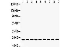 Anti- Peroxiredoxin 1 Picoband antibody, Western blotting All lanes: Anti Peroxiredoxin 1  at 0. (Peroxiredoxin 1 抗体  (Middle Region))
