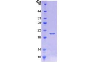 SDS-PAGE analysis of Human CALML5 Protein. (CALML5 蛋白)