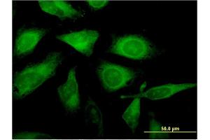 Immunofluorescence of monoclonal antibody to C1orf89 on HeLa cell. (RSG1 抗体  (AA 1-258))