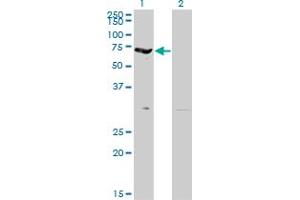 Western Blot analysis of EPB42 expression in transfected 293T cell line by EPB42 monoclonal antibody (M01), clone 2G12. (EPB42 抗体  (AA 623-721))