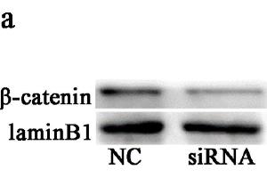 Knockdown of BAMBI suppressed Wnt/β-catenin signaling. (beta Catenin 抗体  (AA 661-781))