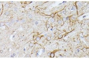 Immunohistochemistry of paraffin-embedded Rat brain using TBCA Polyclonal Antibody at dilution of 1:100 (40x lens). (TBCA 抗体)