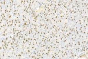 Immunohistochemistry analysis of paraffin-embedded rat pancreas using,IOP2 (ABIN7074883) at dilution of 1: 2000 (NARF 抗体)