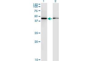 Western Blot analysis of ALLC expression in transfected 293T cell line by ALLC monoclonal antibody (M07), clone 3D3. (Allantoicase 抗体  (AA 235-344))