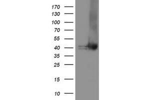 Western Blotting (WB) image for anti-Tubulin Folding Cofactor C (TBCC) antibody (ABIN1501322) (TBCC 抗体)