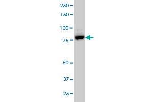 EPS8L2 monoclonal antibody (M01), clone 6C2 Western Blot analysis of EPS8L2 expression in A-431 . (EPS8-Like 2 抗体  (AA 615-714))