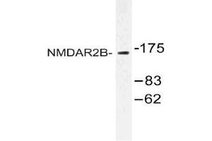 Western blot (WB) analysis of NMDAR2B antibody in extracts from Jurkat cells. (GRIN2B 抗体)