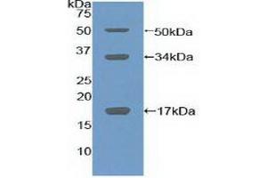 Western Blotting (WB) image for anti-Collagen, Type X (COL10) (AA 547-680) antibody (ABIN7434728)