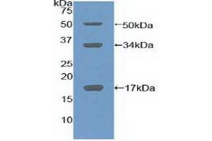 Detection of Recombinant COL10, Mouse using Polyclonal Antibody to Collagen Type X (COL10) (COL10 抗体  (AA 547-680))