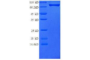 SDS-PAGE (SDS) image for Colony Stimulating Factor 3 Receptor (Granulocyte) (CSF3R) (AA 25-620) protein (GST tag) (ABIN1095616)
