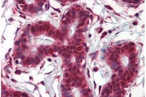 Human Breast (formalin-fixed, paraffin-embedded) stained with NOTCH4 antibody ABIN462184 followed by biotinylated goat anti-rabbit IgG secondary antibody ABIN481713, alkaline phosphatase-streptavidin and chromogen. (NOTCH4 抗体  (AA 371-420))