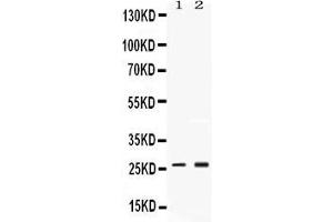 Western blot analysis of PSMA2 expression in rat testis extract ( Lane 1) and MCF-7 whole cell lysates ( Lane 2). (PSMA2 抗体  (Middle Region))